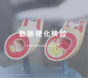 動脈硬化健診